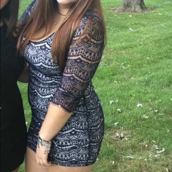 Blue Lace Homecoming Dress - Picture 2 of 4